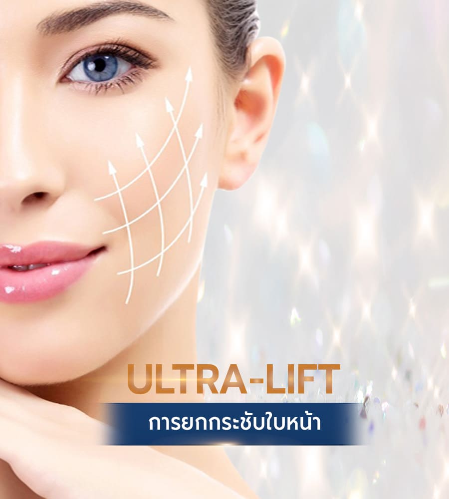 Ultra-Lift – S-mart Clinic